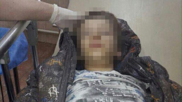 Снимок мальчика без сознания, взорвавший социальные сети по всей России, «добрался» до Липецка