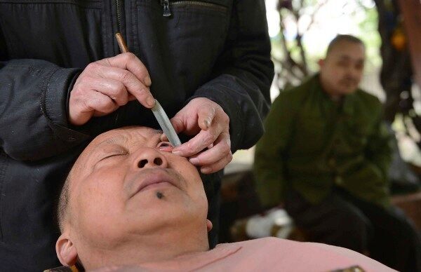 В Китае бреют глаза для улучшения зрения