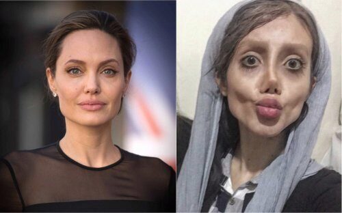 Жительница Ирана сделала 50 пластических операций, чтобы выглядеть как Анжелина Джоли