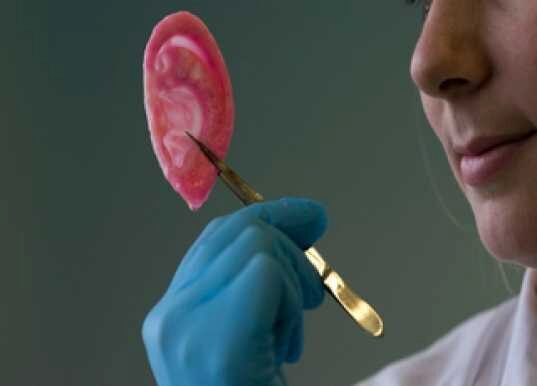 Детям пересадили новые ушные раковины, выращенные из их собственных клеток