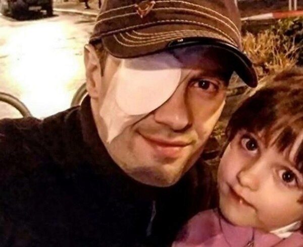 Опухоль на губе и "ерунда" в глазе: Макаров восстанавливается после операции