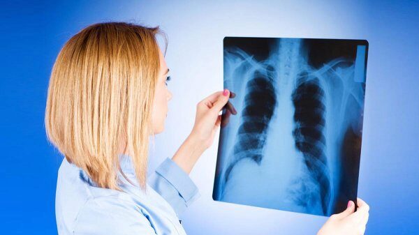 В России ученые изобрели точный тест для определения туберкулеза
