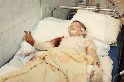 Житель Омска сломал мальчику позвоночник и избил за кражу часов