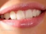 Ученые разработали технологию восстановления зубов без пломбирования