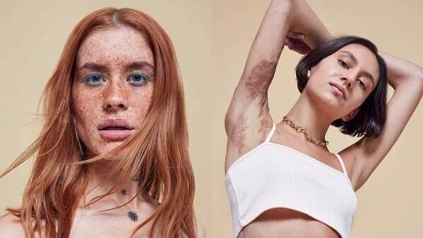 Бренд Missguided сделал необычную рекламу с моделями со шрамами и растяжками