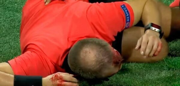 На матче Лиги Европы судье разбили голову бутылкой