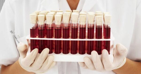 Самую опасную группу крови озвучили ученые