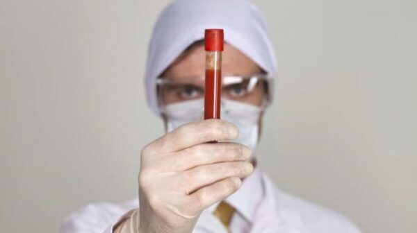 Названа группа крови самая роковая и опасная: с ней страшно жить, утверждают ученые