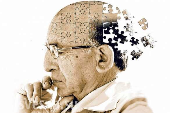 Ученые случайно открыли лекарство от болезни Альцгеймера