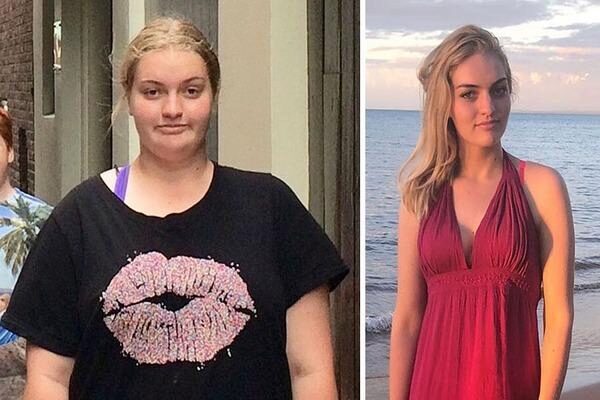 Жуйте ее вместо сладкого: неожиданный продукт помог австралийской девушке похудеть на 63 кг