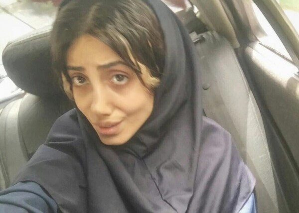Девушка из Ирана сделала 50 операций, чтобы стать Анджелиной Джоли