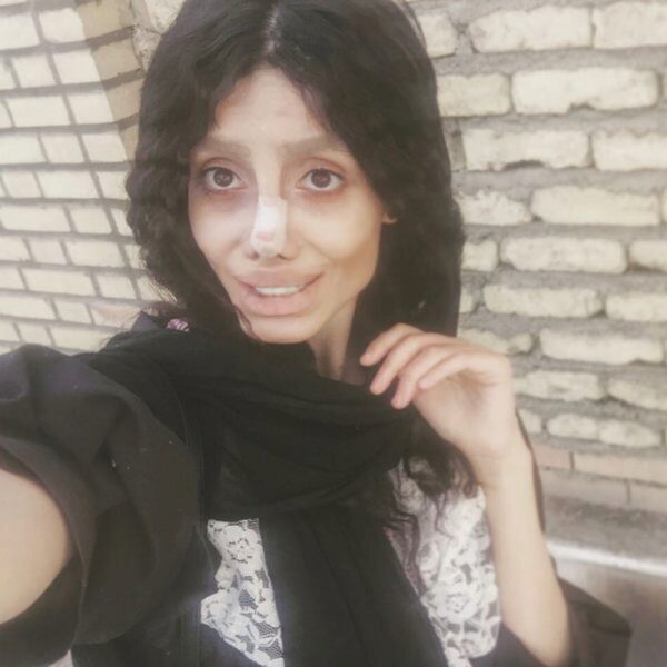 Иранка сделала 50 операций, чтобы стать похожей на Анджелину Джоли