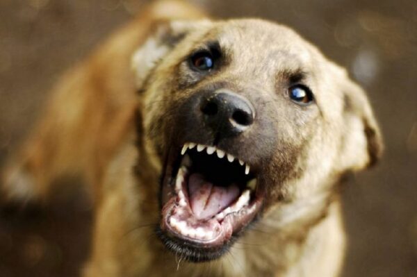 Искусанный 13-ю собаками школьник в Иваново в реанимации в крайне тяжелом состоянии