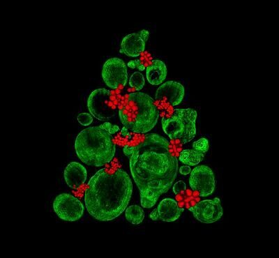Британская аспирантка создала «елку» из стволовых клеток