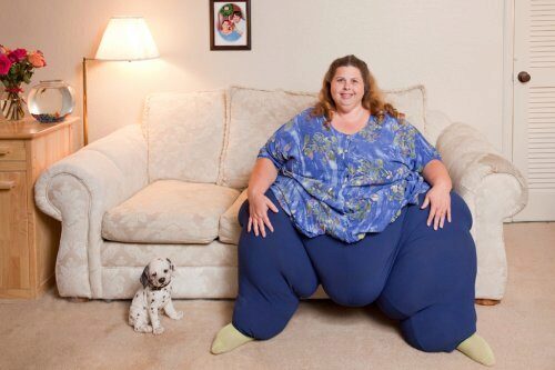 Новосибирские врачи ушили желудок женщине весом 185 килограммов
