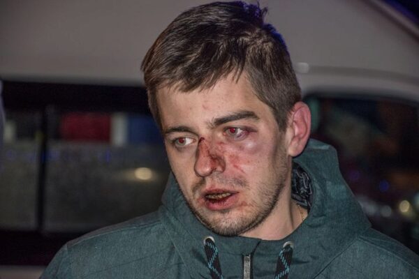 Работники одной из киевских пиццерий избили собственных гостей