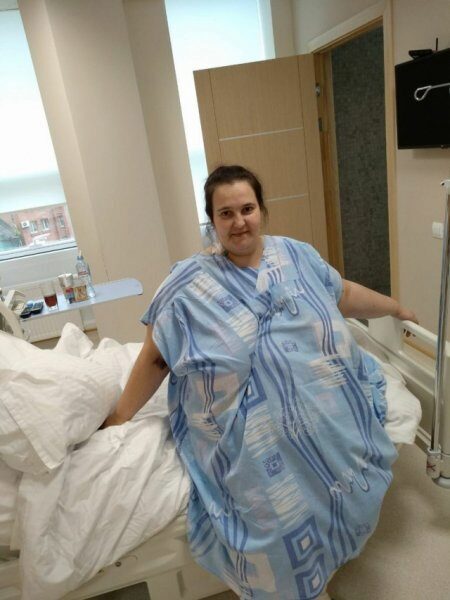 В Новосибирске женщине весом в 185 кг бесплатно ушили желудок