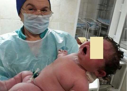 48-летняя женщина родила девочку весом 6400 граммов