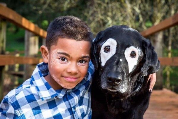 Мальчик и собака стали друзьями из-за одинаковой болезни