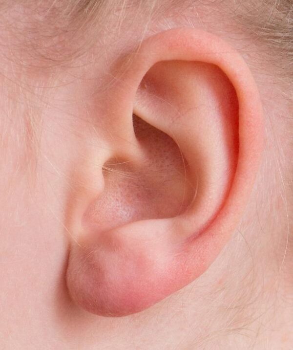 В Китае детям пересадили клонированные уши из клеток пациентов