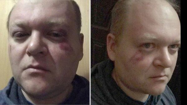 В Украине неизвестные избили участника травести-шоу