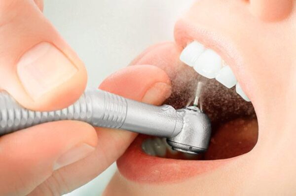 Ученые создали пломбу, способную лечить больной зуб