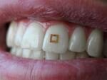 Ученые разработали наклейку на зуб, которая поможет контролировать диету и качество пищи