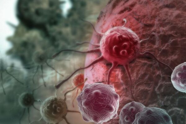 Ученые: Выявляющий рак пластырь сообщит о недуге с помощью черной родинки