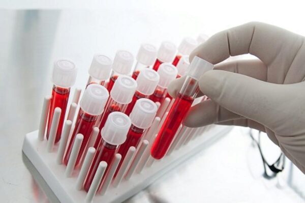 Ученые нашли новый способ лечения рака крови