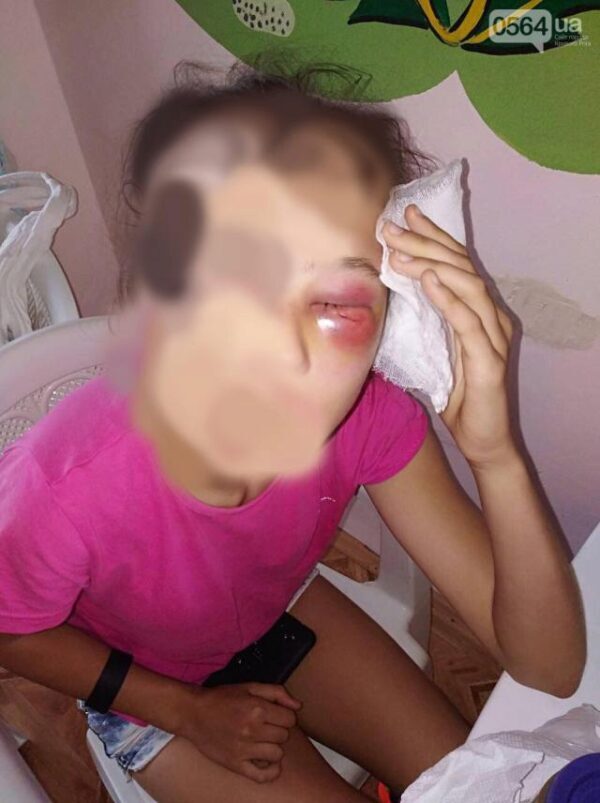 В Кривом Роге школьница зверски избила девочку-подростка: появились жуткие фото