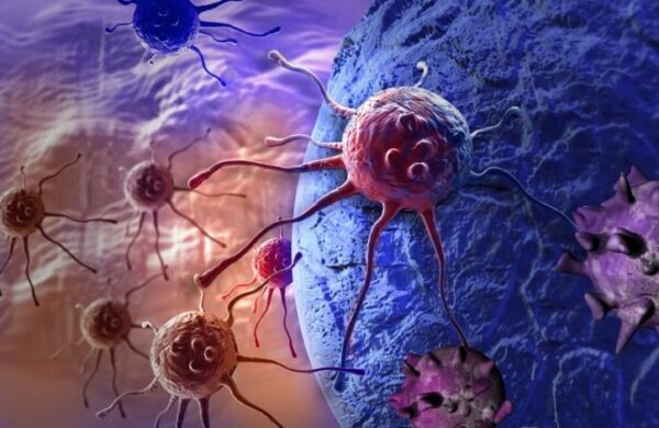 Фактор, который в четыре раза повышает риск развития рака, назвали ученые