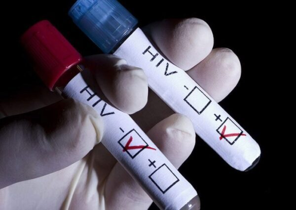 Россия заняла первое место по скорости распространения ВИЧ