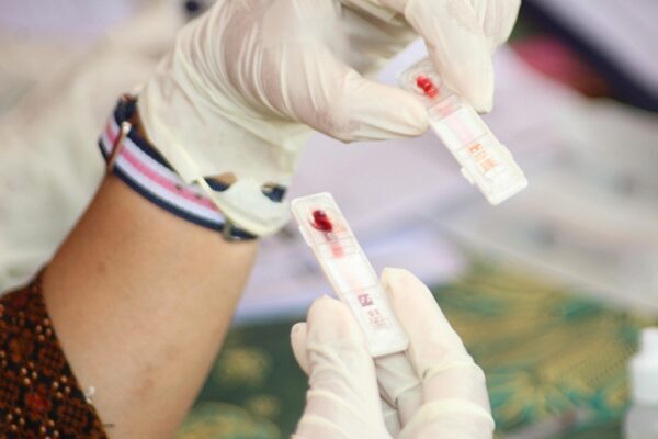 Роспотребнадзор: лечение от ВИЧ в Российской Федерации получают 56,6% инфицированных