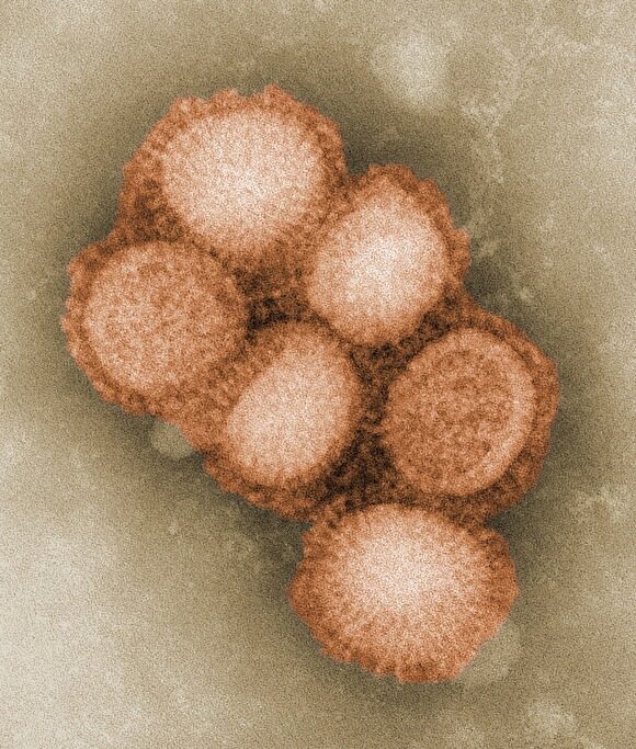 В Грузии от «свиного гриппа» погибло шесть человек