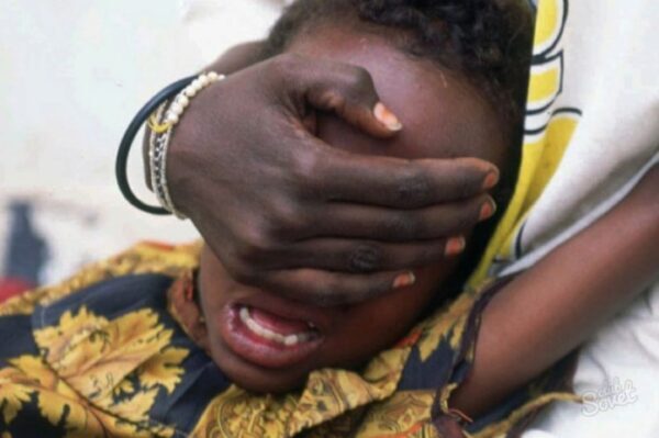 В Великобритании впервые осудили за женское обрезание