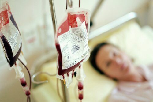 Во время лечения рака печени переливание крови увеличивает риск рецидива и смерти