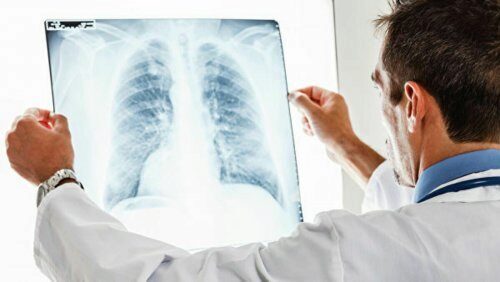 Тальк поможет вылечить болезни лёгких – Медики