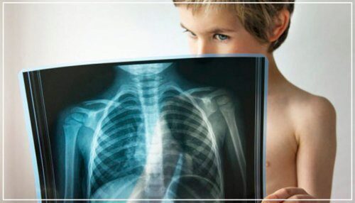 Виртуальная реальность помогает детям не бояться рентгена
