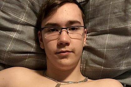 В Англии 15-летнего подростка приковал к постели вросший волос