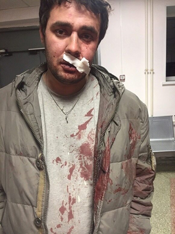 Челябинского депутата, избитого возле ночного кафе, лишили статуса помощника Бурматова