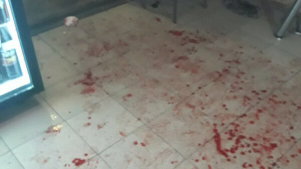 Полиция изучает обстоятельства кровавой драки в грязинском баре