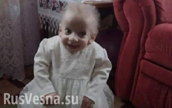 На Украине восьмилетняя девочка умерла от старости (ФОТО, ВИДЕО)