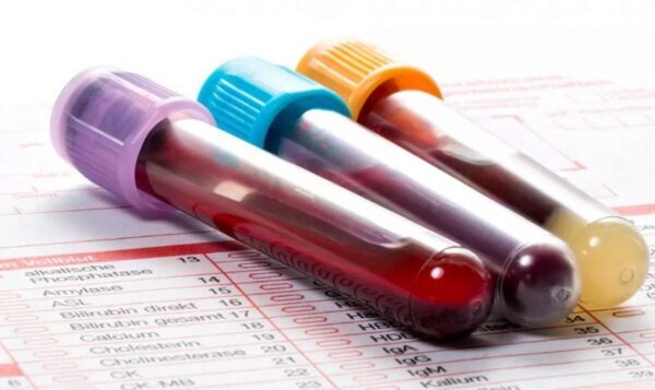 Новый анализ крови может обнаружить более 50 видов рака