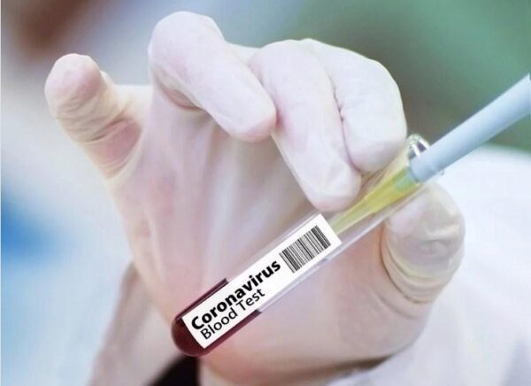 Российские ученые рассказали, влияет ли коронавирус на бесплодие