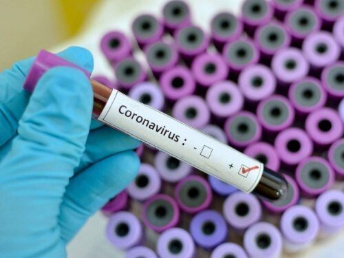 Ученые: Коронавирус не является биологическим оружием