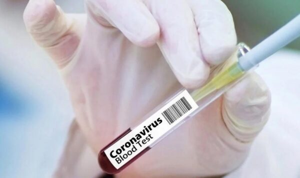 В России появился мобильный экспресс-тест на коронавирус