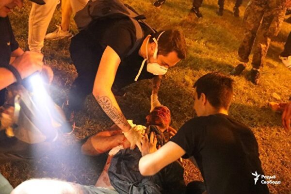СМИ опубликовали снимки белоруссов, которые пострадали при столкновении с силовиками