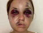 Спасшаяся от изнасилования в поезде Киев-Мариуполь рассказала, как ей удалось сбежать
