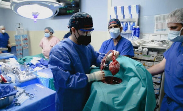 Человеку впервые успешно пересадили сердце животного (видео)