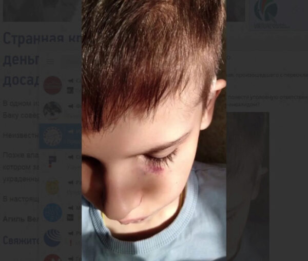 В Крыму в спецшколе мальчика-инвалида всего избили и, возможно, изнасиловали
